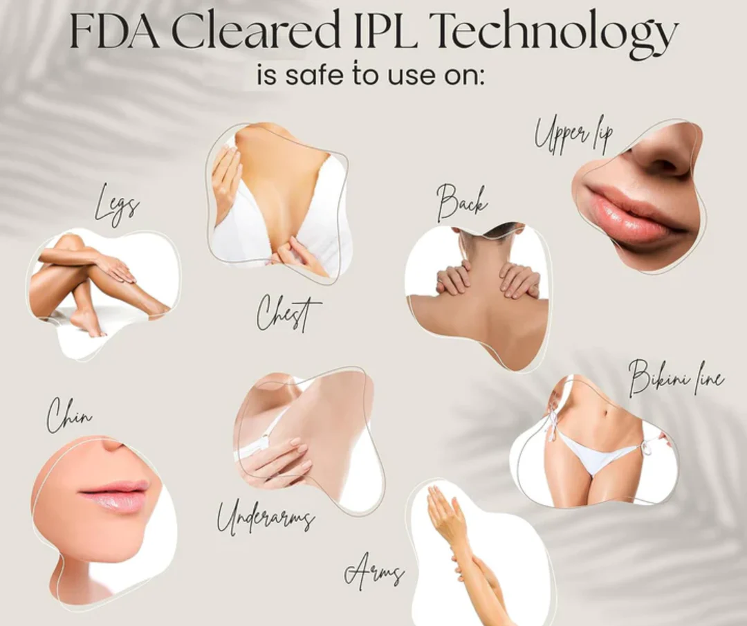 IPL Laser Hair Removal | The Leading At-Home Solution for Smooth Skin